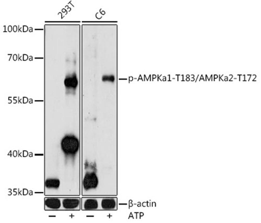 Western blot - Phospho-AMPKa1-T183/AMPKa2-T172 antibody (AP0883)