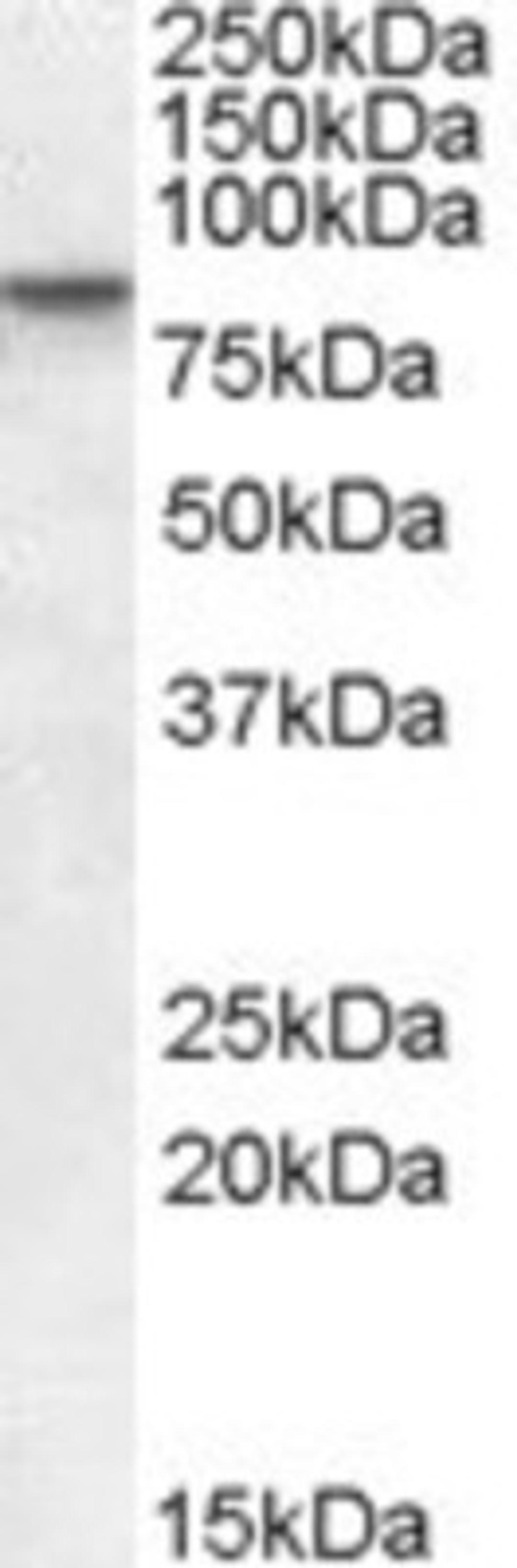 Western Blot: SETDB2 Antibody [NB100-1137] - (0.5ug/ml) staining of human heart lysate (35ug protein in RIPA buffer). Primary incubation was 1 hour. Detected by chemiluminescence.