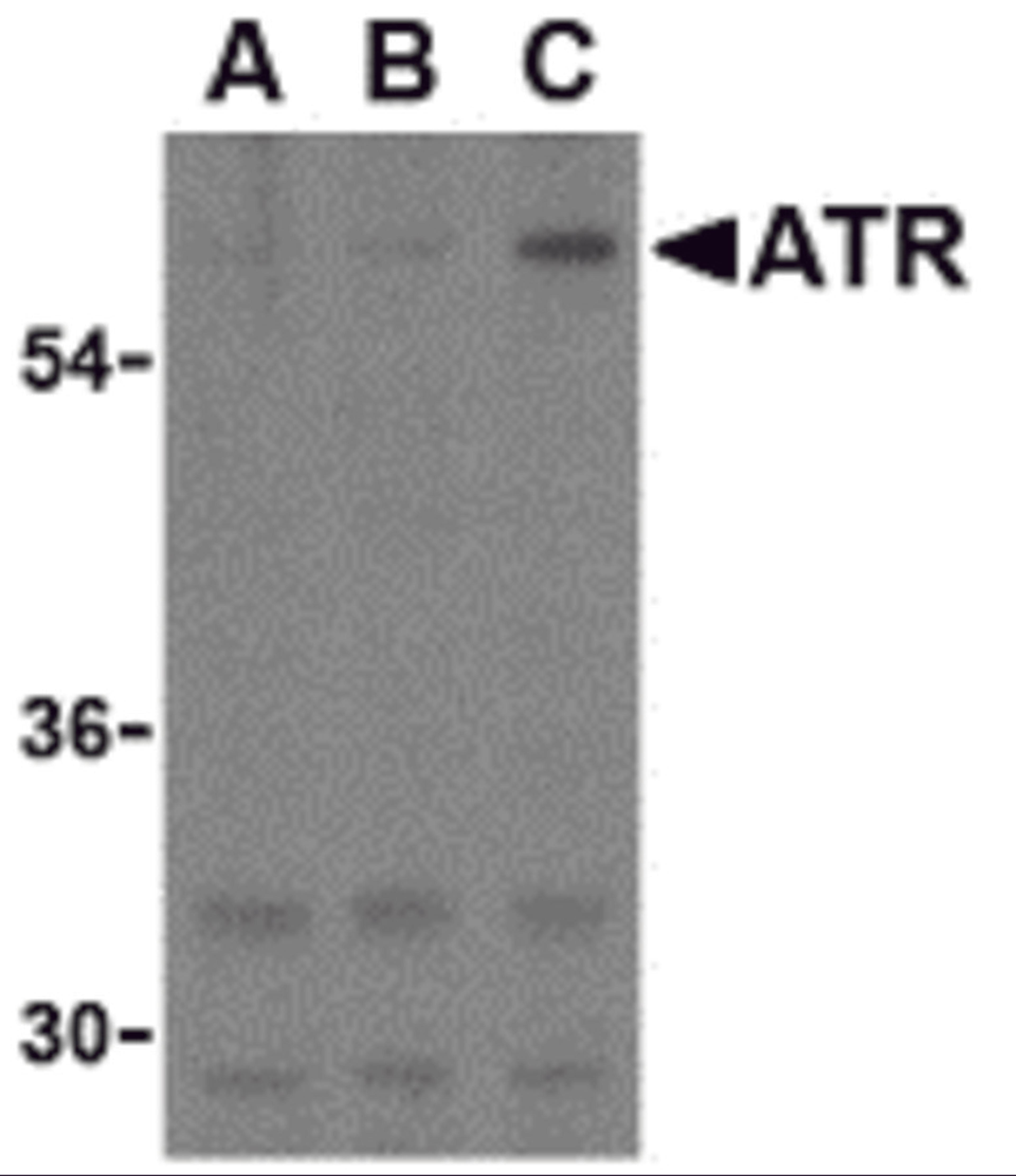 Western blot analysis of ATR in K562 cell lysates with ATR antibody at (A) 0.5, (B) 1, and (C) 2 &#956;g/mL. 