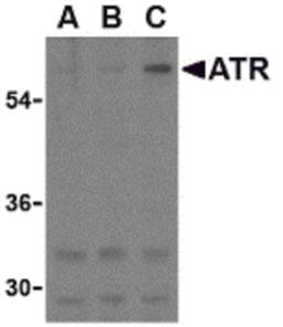 Western blot analysis of ATR in K562 cell lysates with ATR antibody at (A) 0.5, (B) 1, and (C) 2 μg/mL.