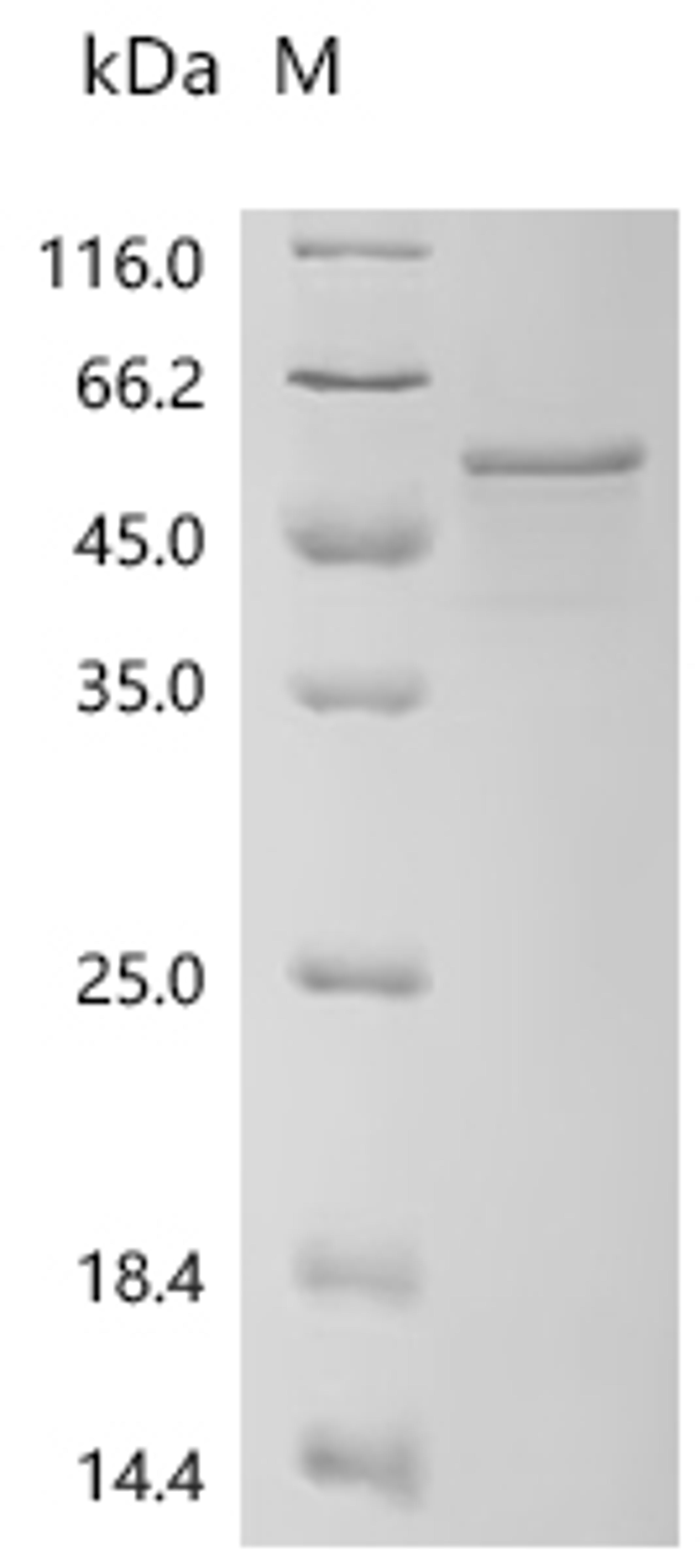 (Tris-Glycine gel) Discontinuous SDS-PAGE (reduced) with 5% enrichment gel and 15% separation gel.