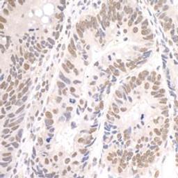 Detection of human Paf1 by immunohistochemistry.