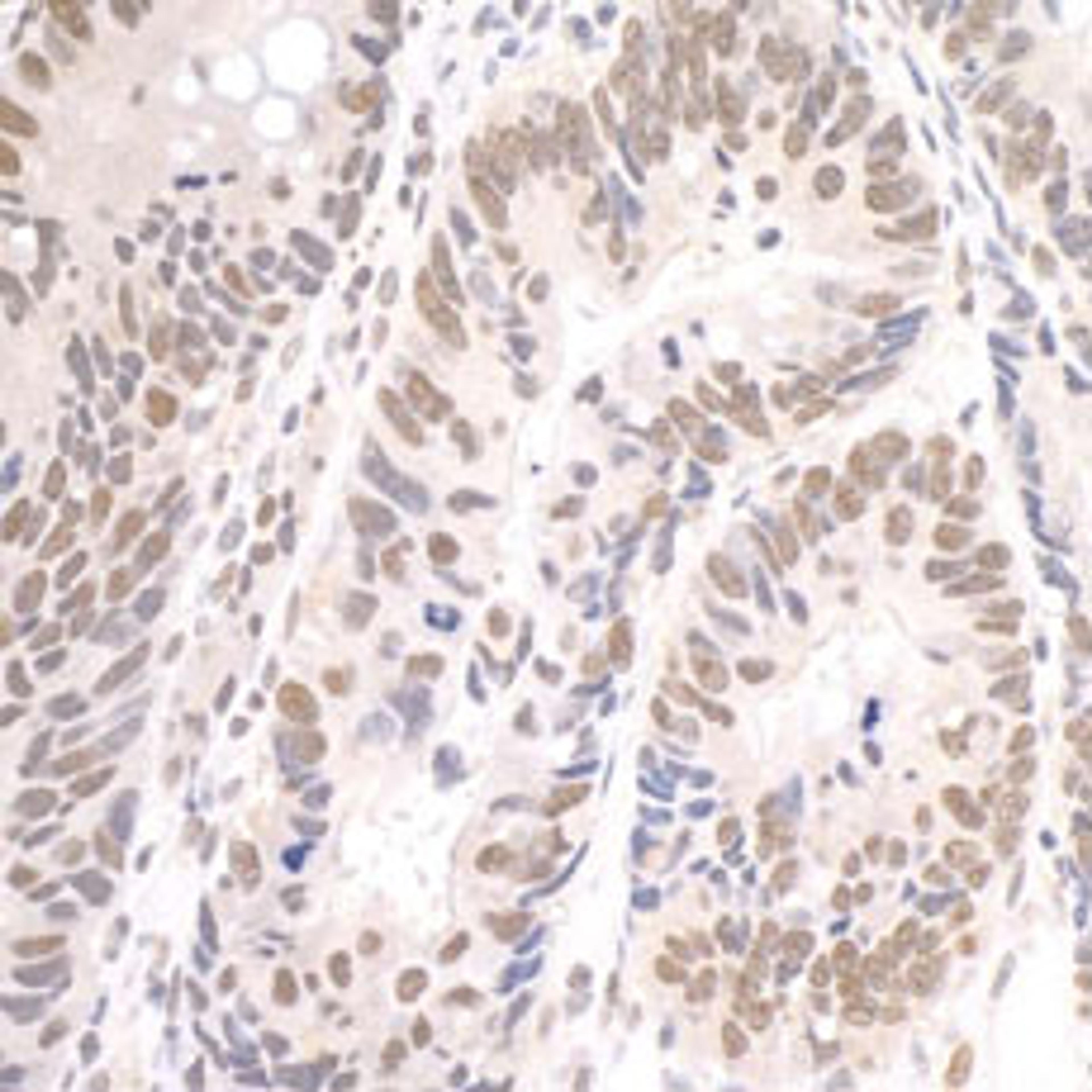 Detection of human Paf1 by immunohistochemistry.