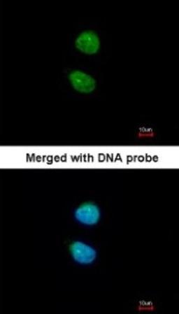 Immunocytochemistry/Immunofluorescence: ZKSCAN3 Antibody [NBP1-31566] - Paraformaldehyde-fixed HeLa, using antibody at 1:200 dilution.