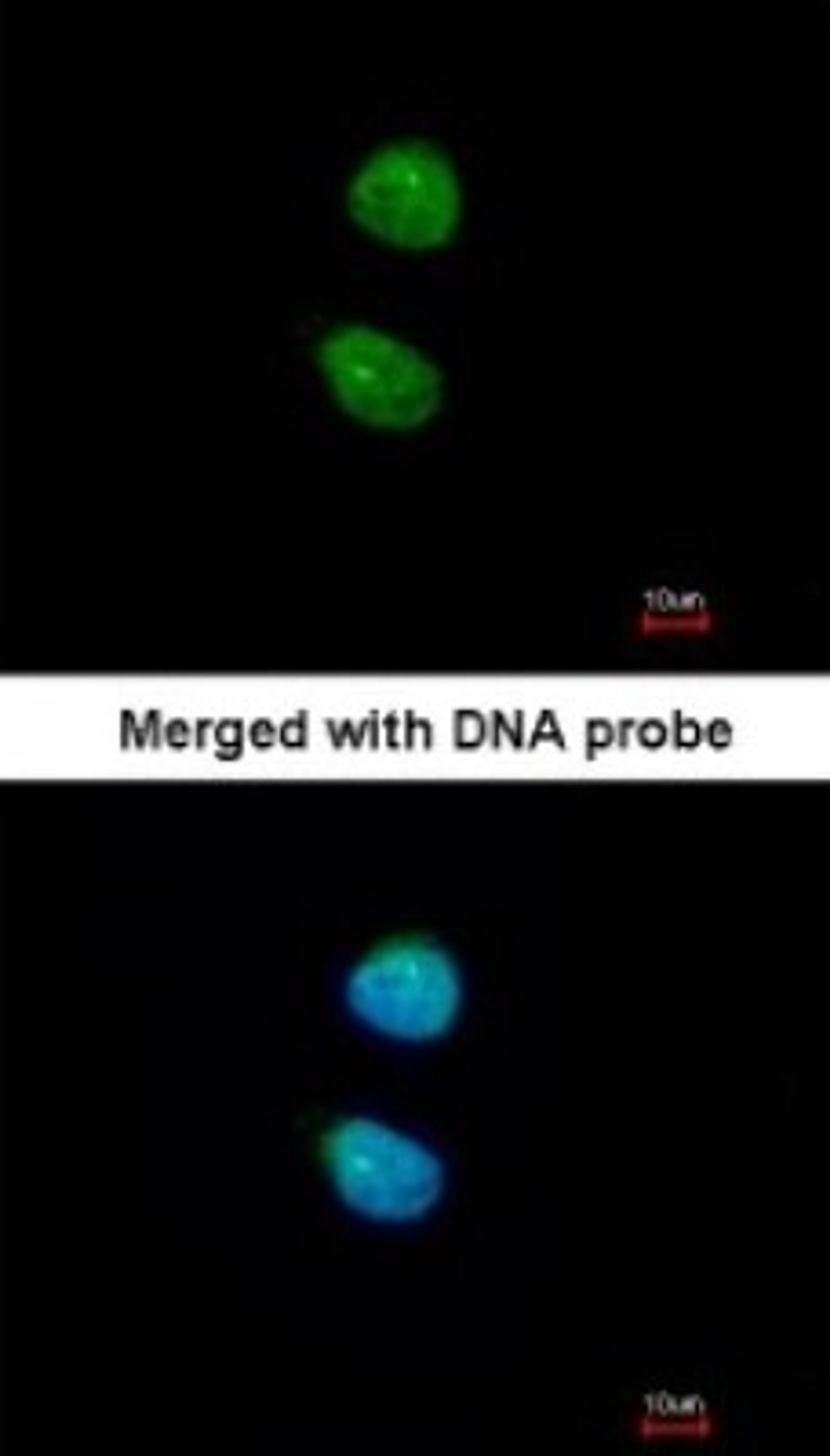 Immunocytochemistry/Immunofluorescence: ZKSCAN3 Antibody [NBP1-31566] - Paraformaldehyde-fixed HeLa, using antibody at 1:200 dilution.