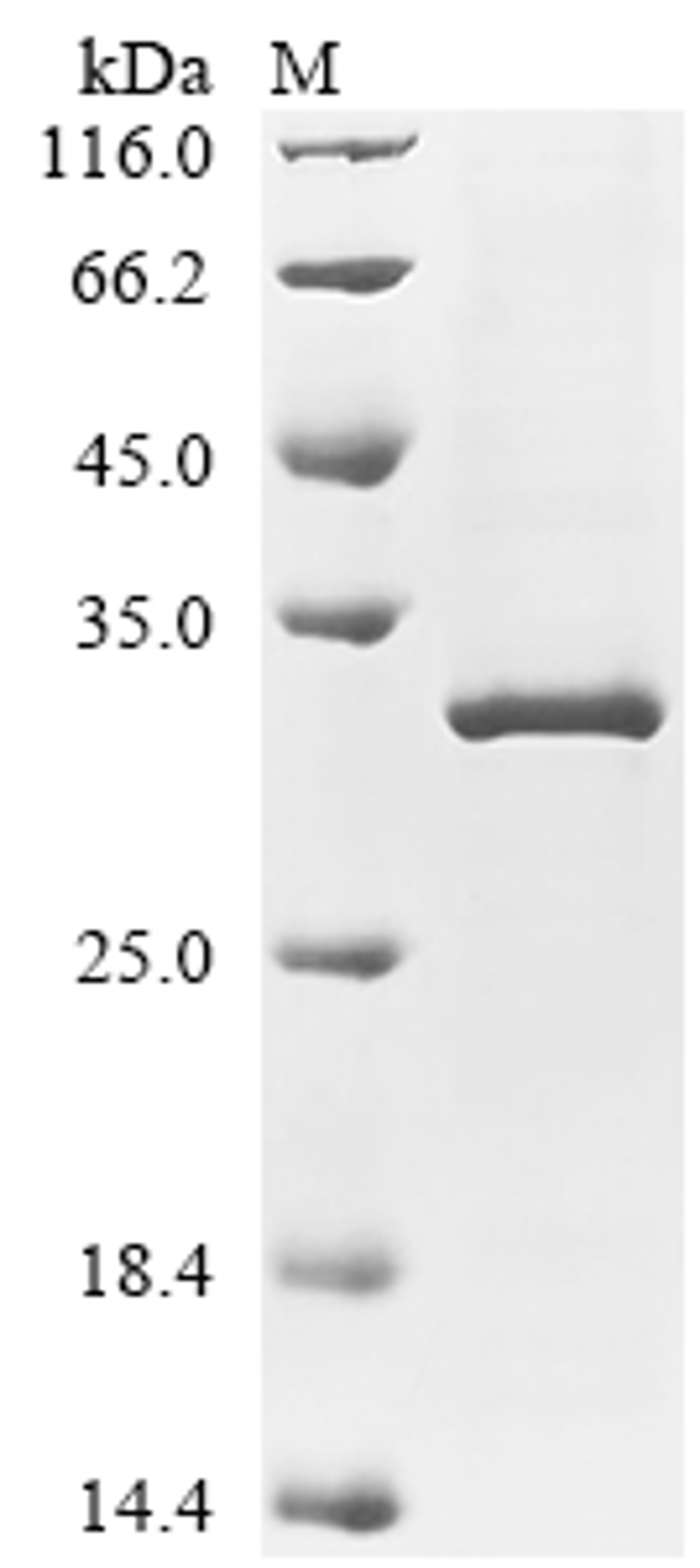 (Tris-Glycine gel) Discontinuous SDS-PAGE (reduced) with 5% enrichment gel and 15% separation gel.
