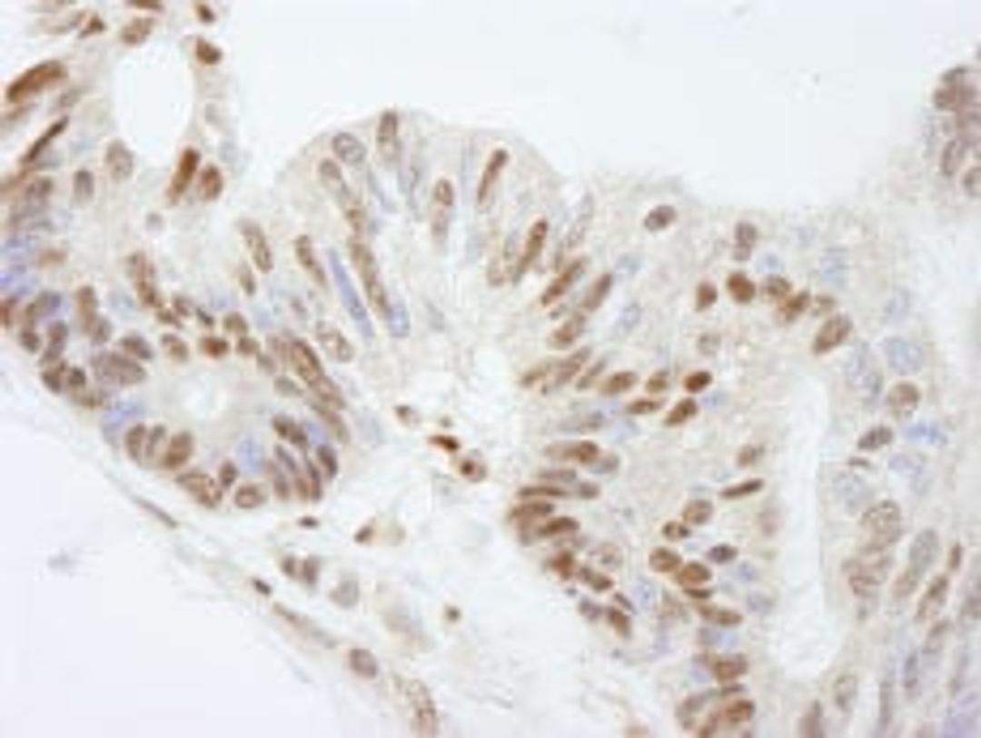 Detection of human FKBP5/FKBP51 by immunohistochemistry.