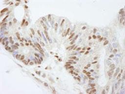 Detection of human FKBP5/FKBP51 by immunohistochemistry.