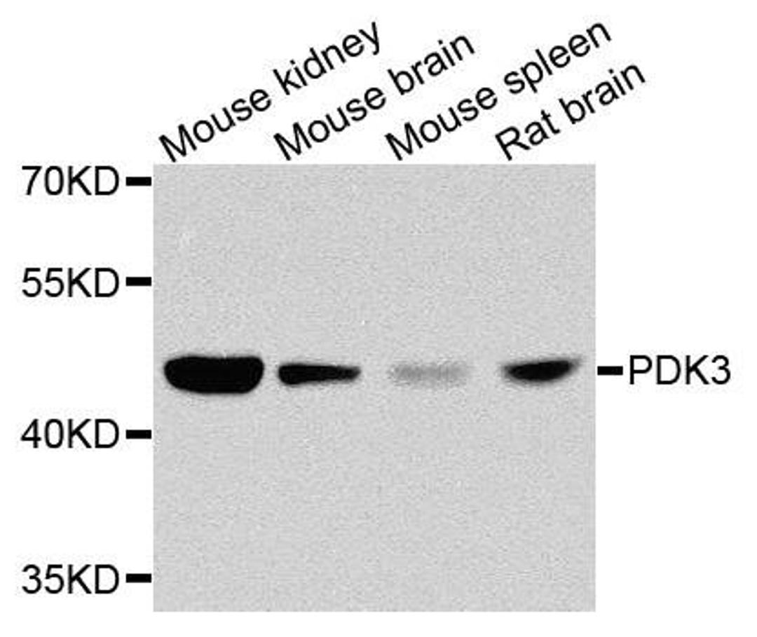 Western blot analysis of extracts of various cells using PDK3 antibody