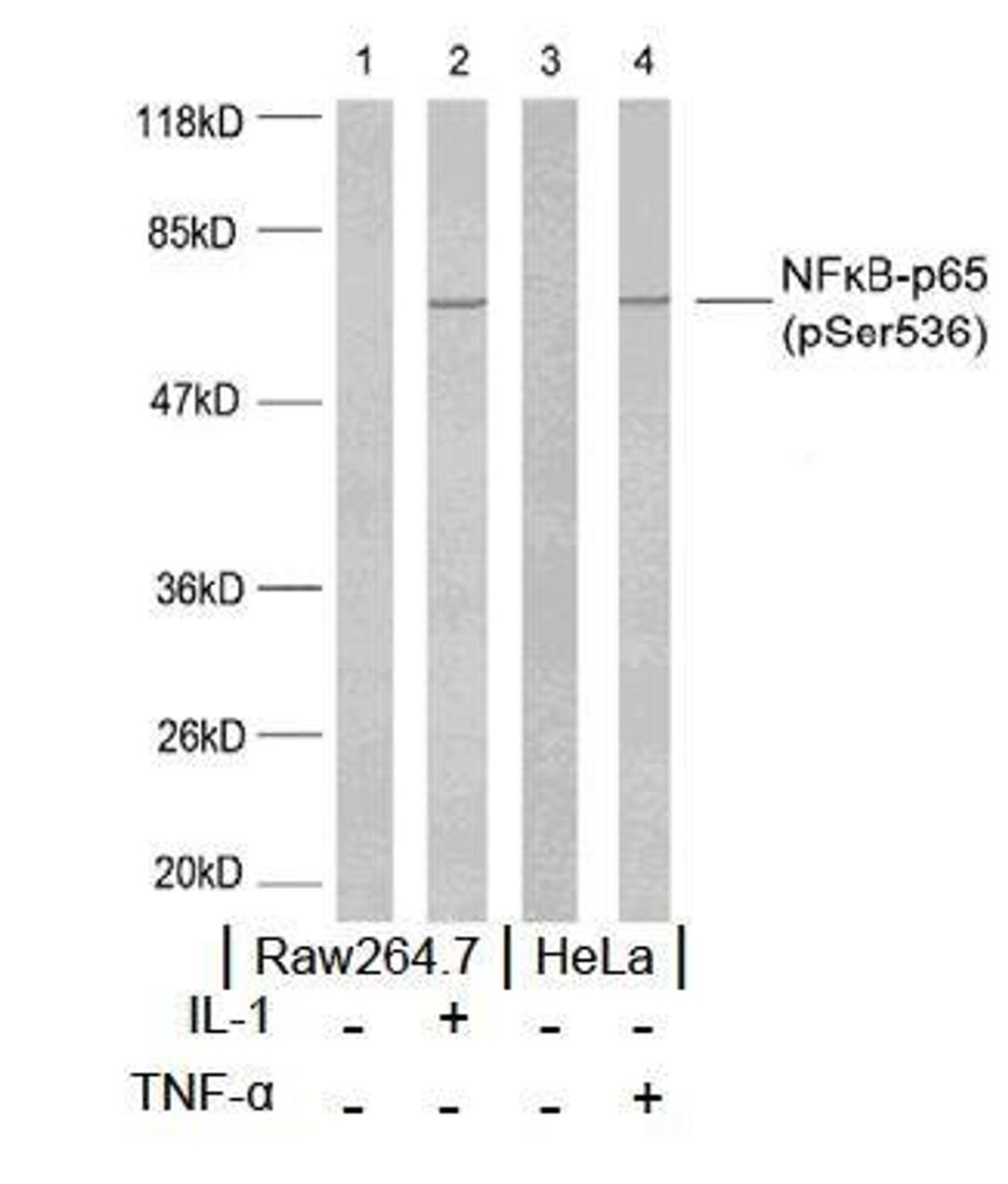 Western blot analysis using NF-?B p65 (phospho-Ser536) antibody