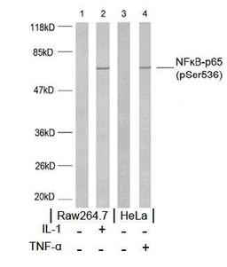 Western blot analysis using NF-?B p65 (phospho-Ser536) antibody