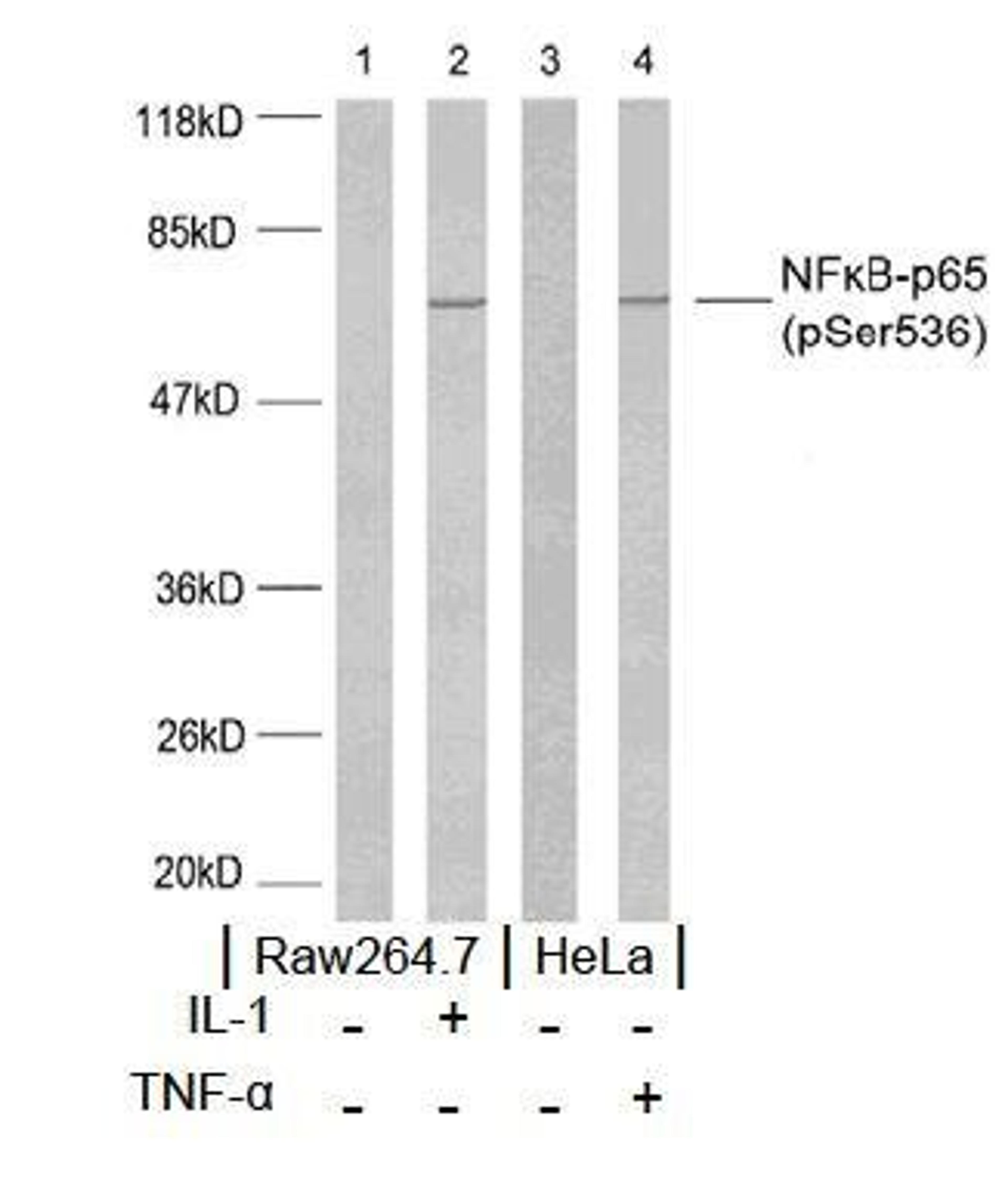 Western blot analysis using NF-?B p65 (phospho-Ser536) antibody