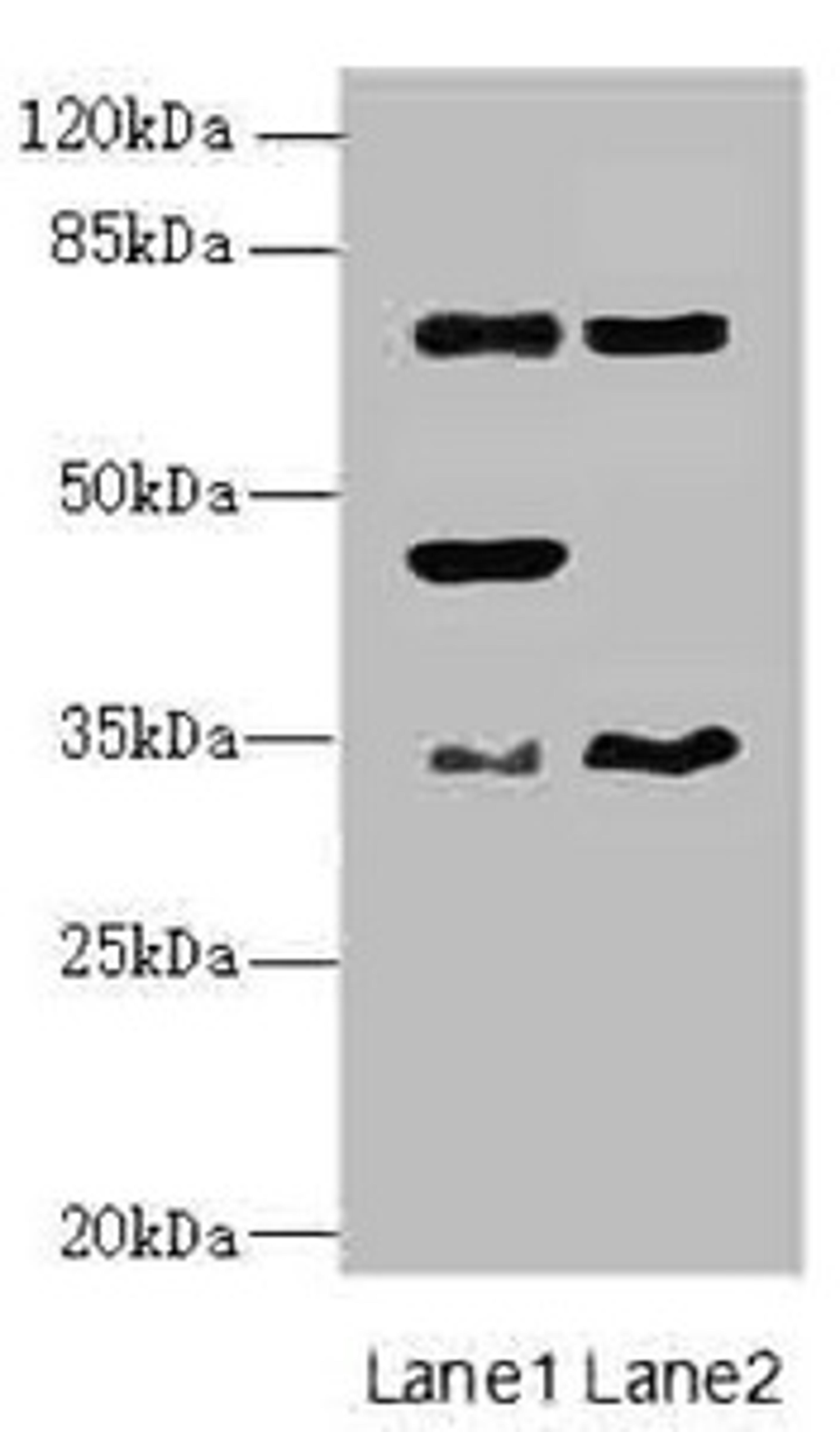 Western blot. All lanes: EHF antibody at 4.95ug/ml. Lane 1: Mouse brain tissue. Lane 2: Mouse lung tissue. Secondary. Goat polyclonal to rabbit IgG at 1/10000 dilution. Predicted band size: 35, 33, 38 kDa. Observed band size: 35, 45, 63 kDa.