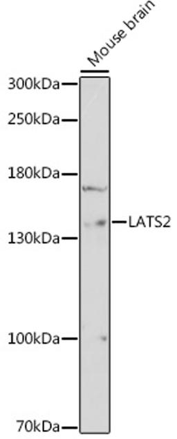 Western blot - LATS2 antibody (A16249)