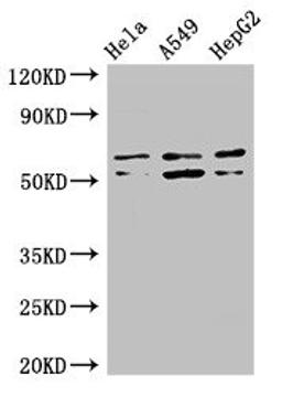 Western Blot. Positive WB detected in: Hela whole cell lysate, A549 whole cell lysate, HepG2 whole cell lysate. All lanes: COQ8B antibody at 3µg/ml. Secondary. Goat polyclonal to rabbit IgG at 1/50000 dilution. Predicted band size: 61, 56 kDa. Observed band size: 61, 56 kDa