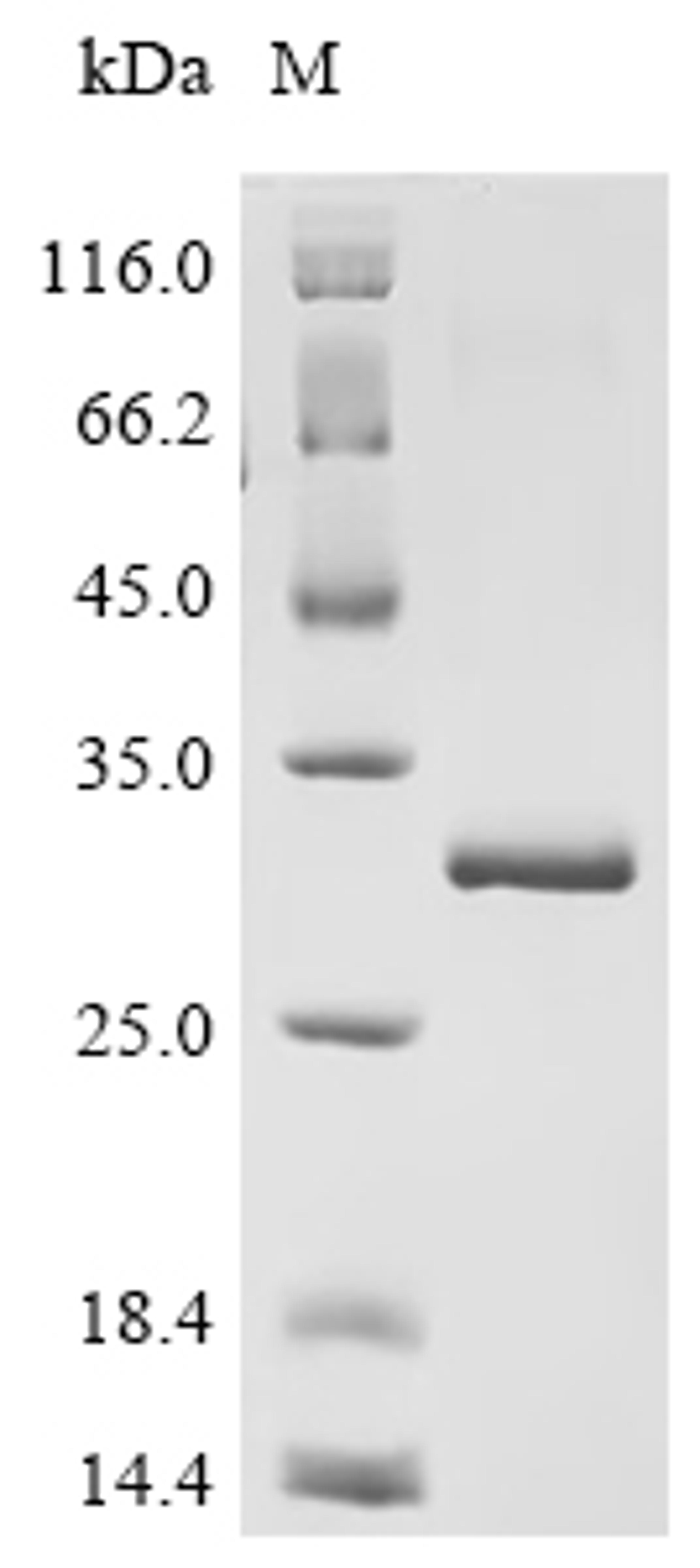(Tris-Glycine gel) Discontinuous SDS-PAGE (reduced) with 5% enrichment gel and 15% separation gel.