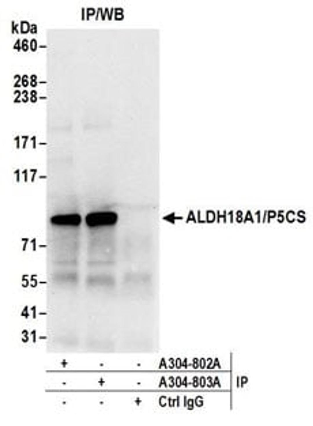 Detection of human ALDH18A1/P5CS by western blot of immunoprecipitates.