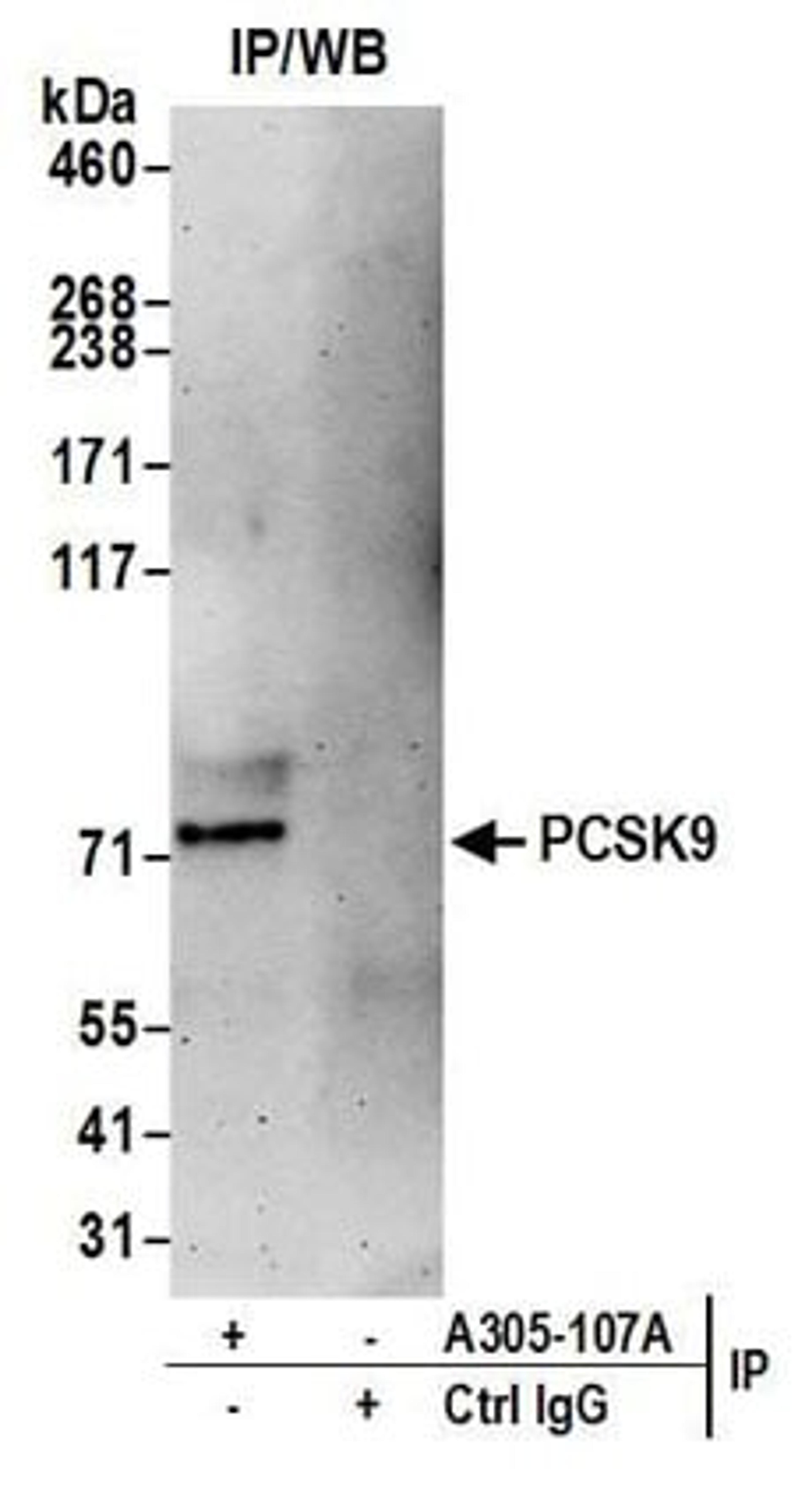 Detection of human PCSK9 by western blot of immunoprecipitates.