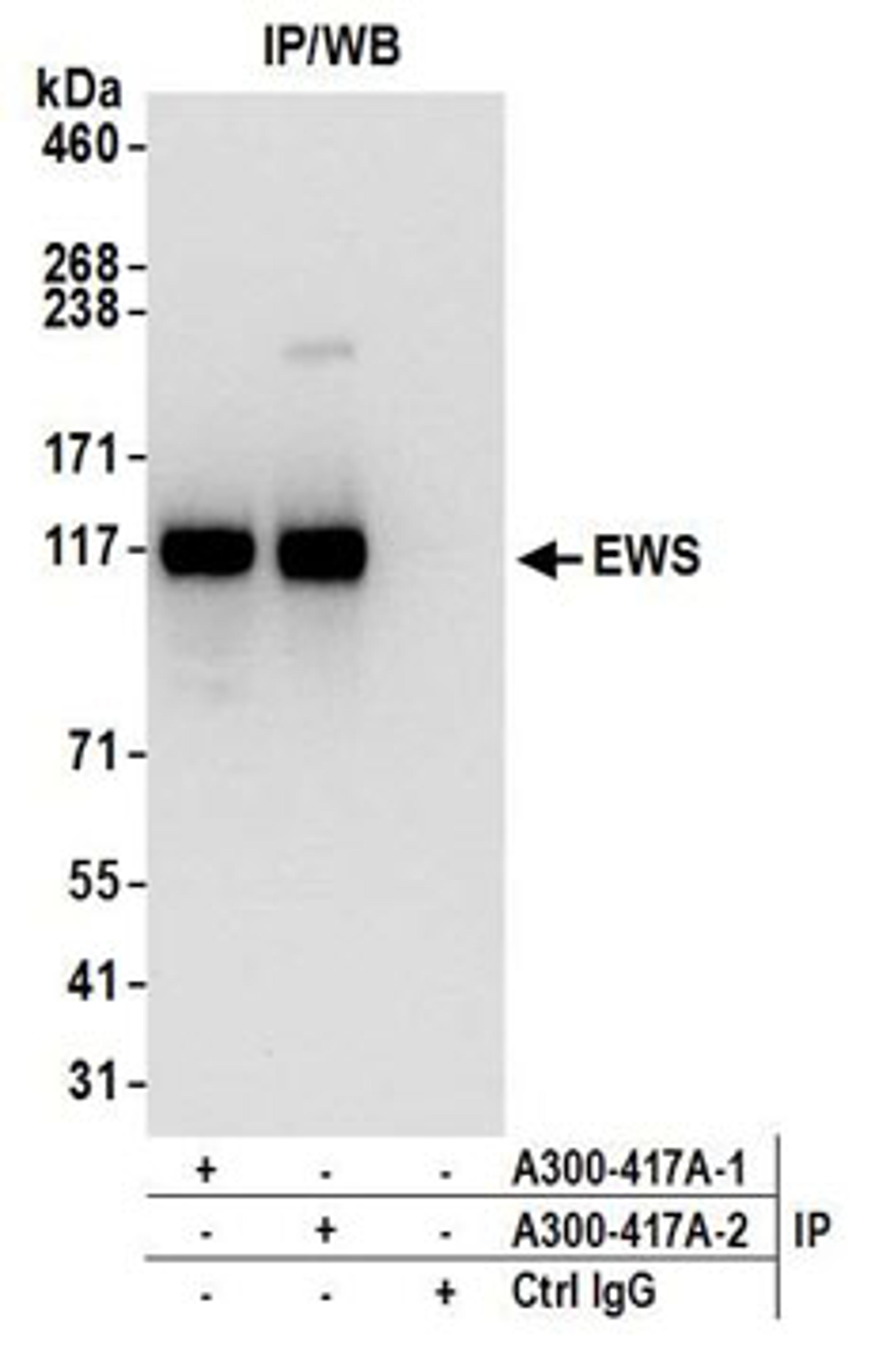 Detection of human EWS by western blot of immunoprecipitates.