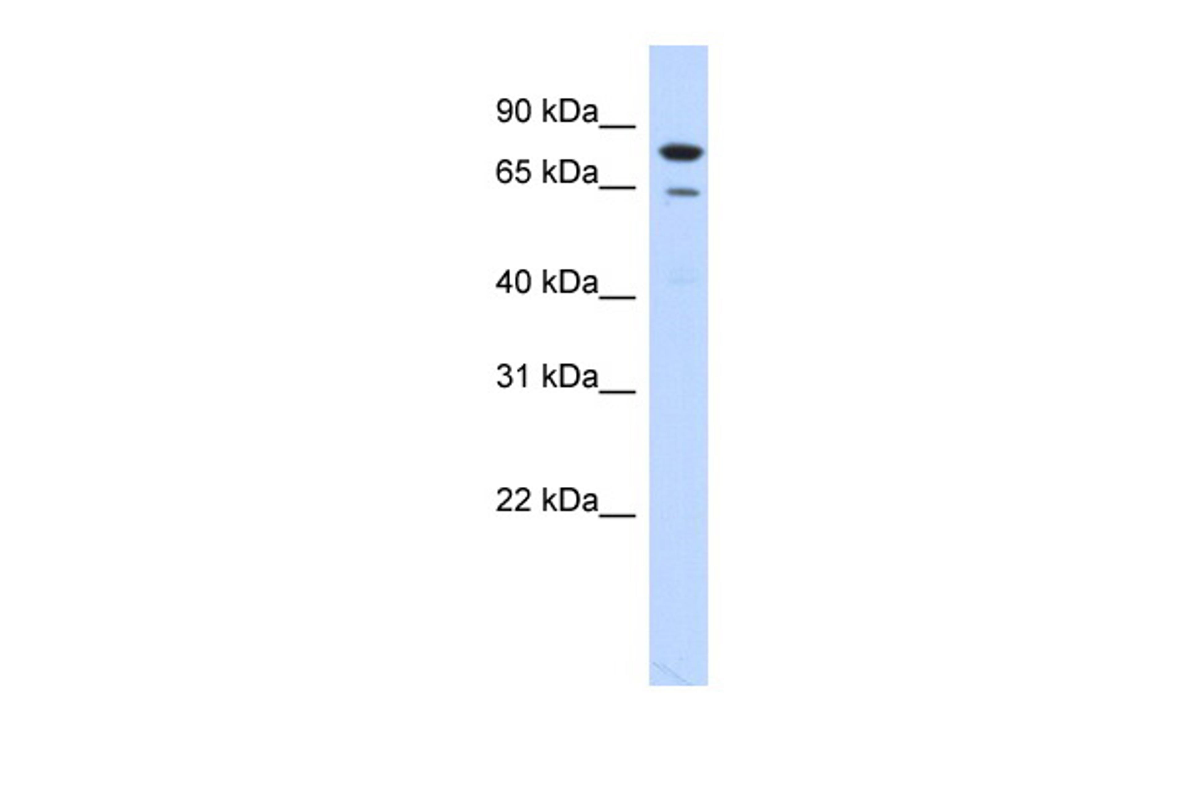 Antibody used in WB on Transfected 293T at 0.2-1 ug/ml.