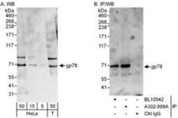 Detection of human gp78 by western blot and immunoprecipitation.