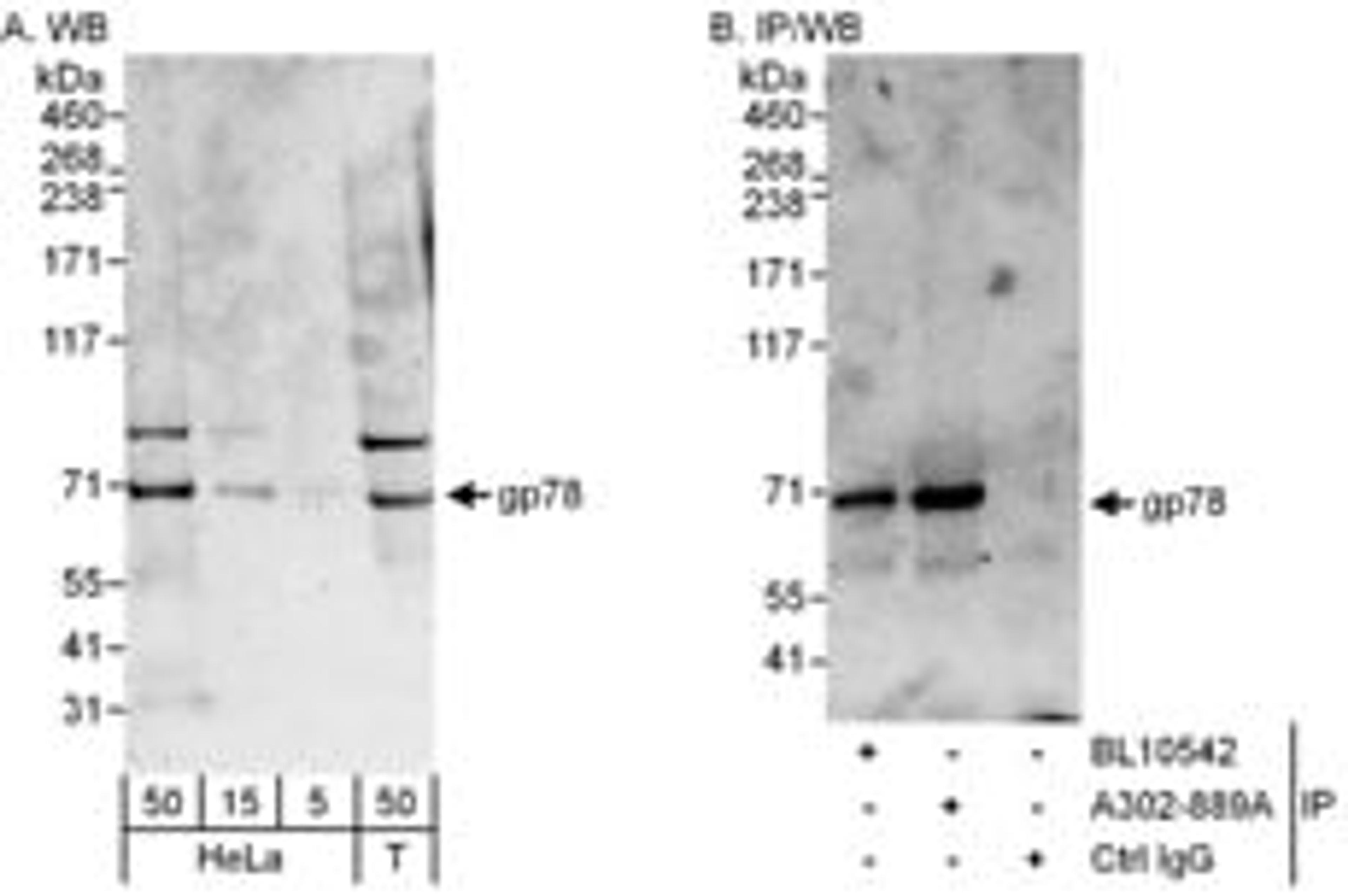 Detection of human gp78 by western blot and immunoprecipitation.