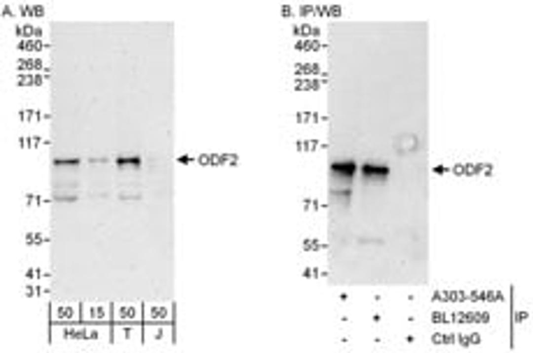 Detection of human ODF2 by western blot and immunoprecipitation.