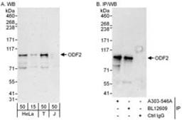 Detection of human ODF2 by western blot and immunoprecipitation.