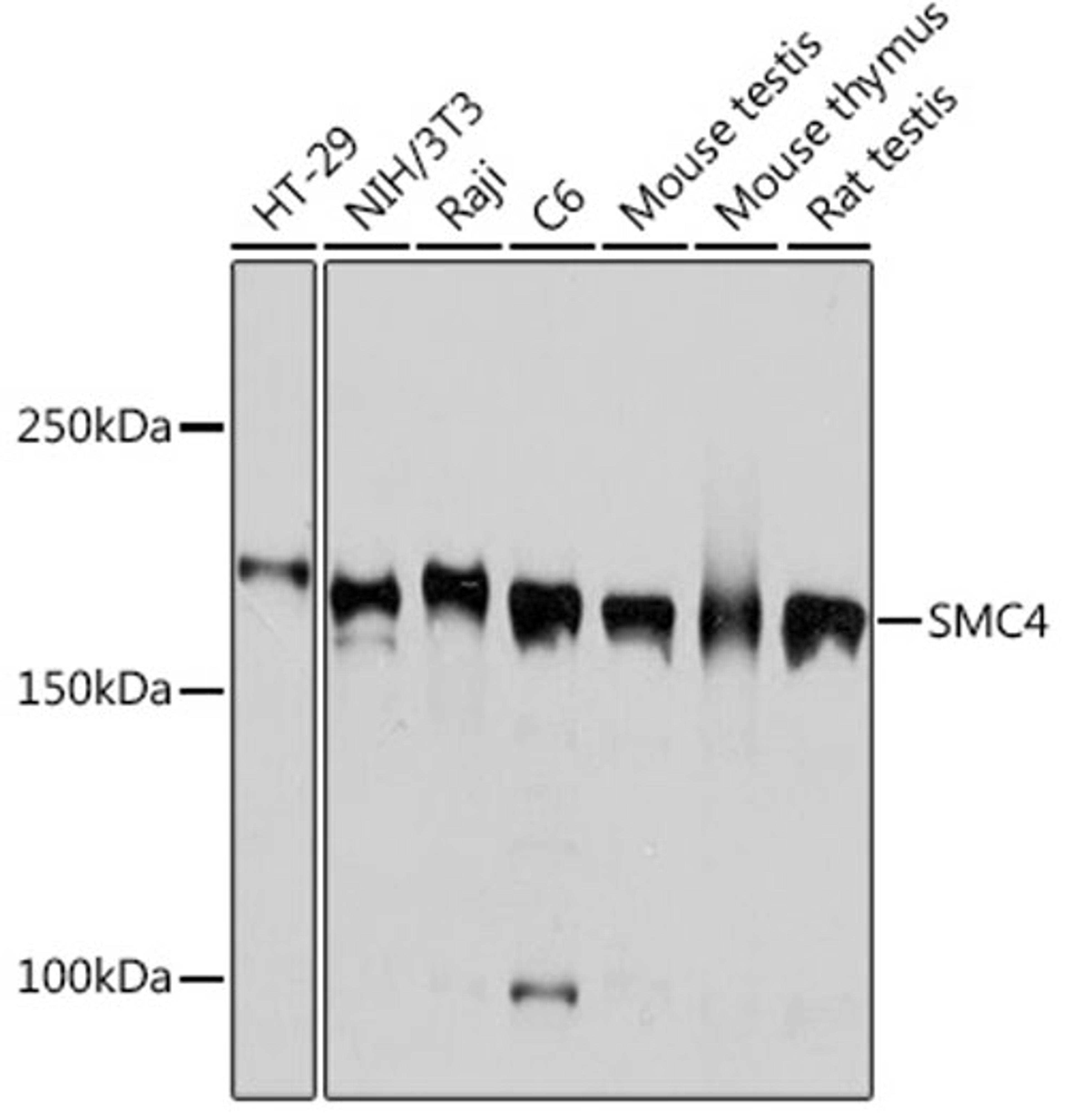 Western blot - SMC4 Rabbit mAb (A3559)