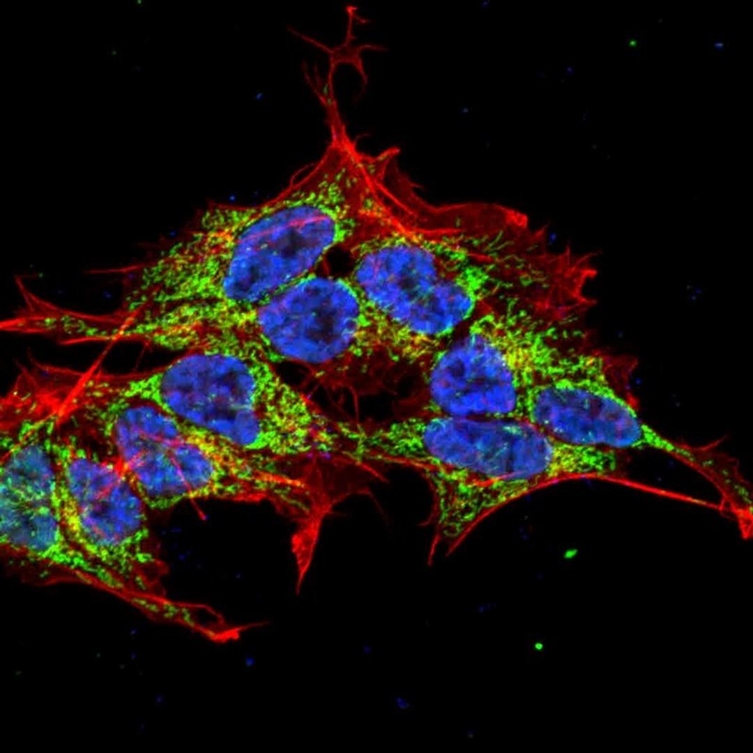 Immunofluorescence analysis of neuroblastoma cell line sk-n-be using REEP1/2 antibody