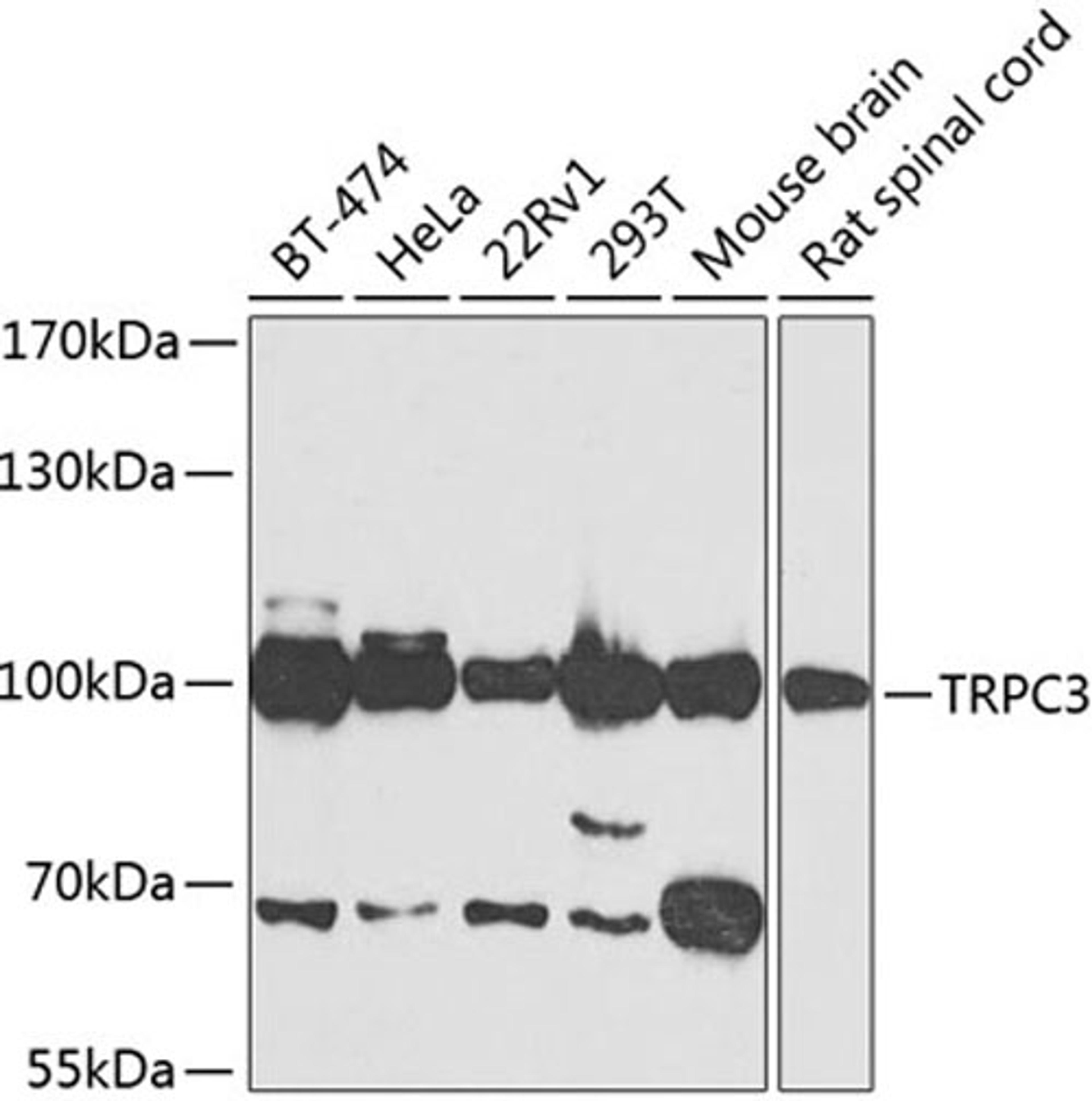 Western blot - TRPC3 antibody (A7742)