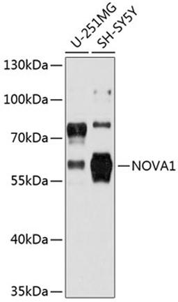 Western blot - NOVA1 antibody (A12030)