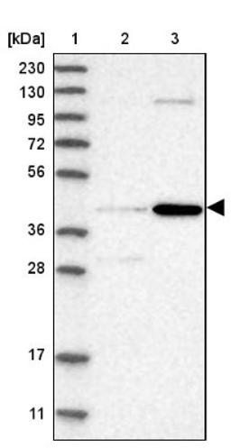 Western Blot: CHRDL2 Antibody [NBP1-88560] - Lane 1: Marker [kDa] 230, 130, 95, 72, 56, 36, 28, 17, 11<br/>Lane 2: Human cell line RT-4<br/>Lane 3: Human cell line U-251MG sp