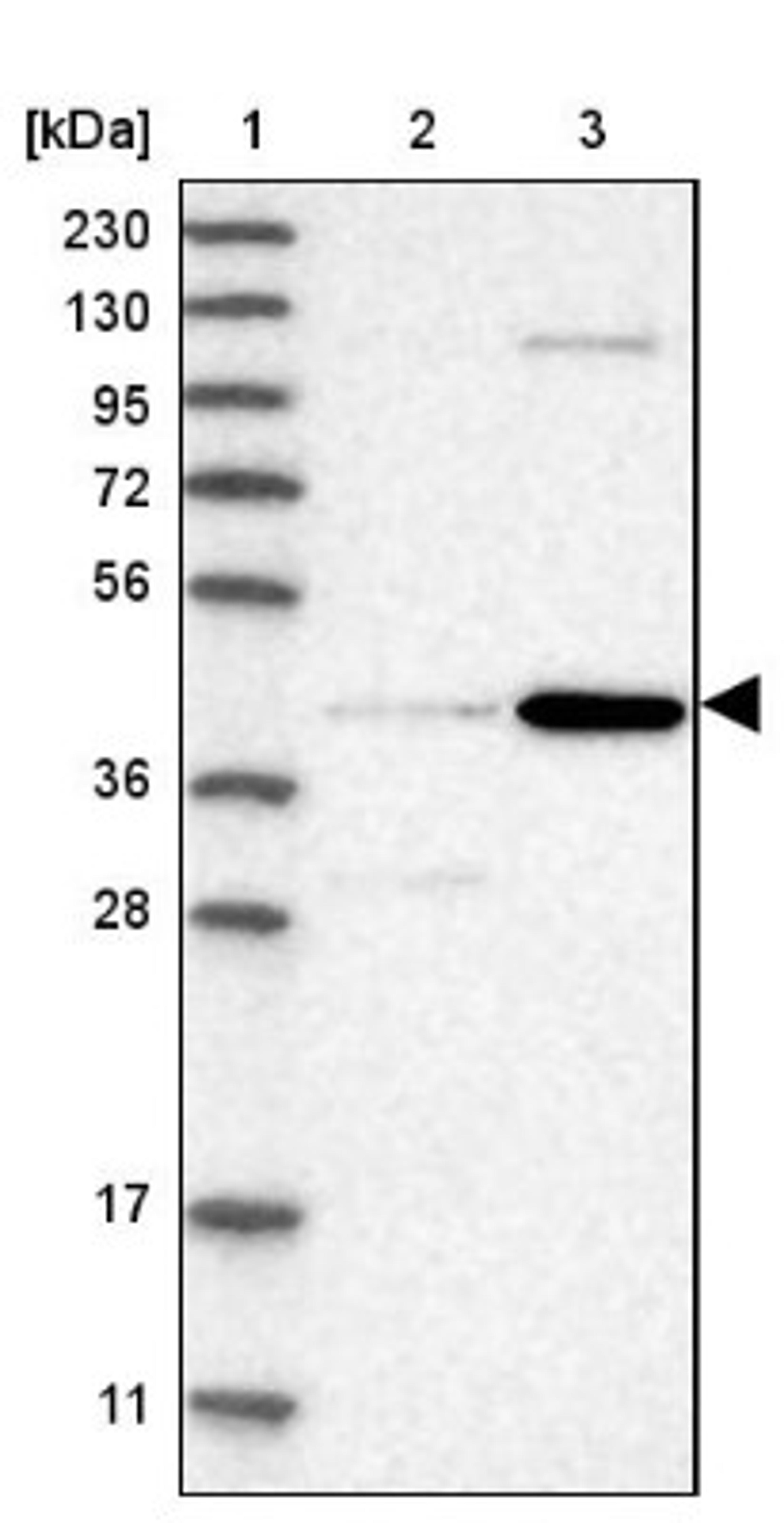 Western Blot: CHRDL2 Antibody [NBP1-88560] - Lane 1: Marker [kDa] 230, 130, 95, 72, 56, 36, 28, 17, 11<br/>Lane 2: Human cell line RT-4<br/>Lane 3: Human cell line U-251MG sp