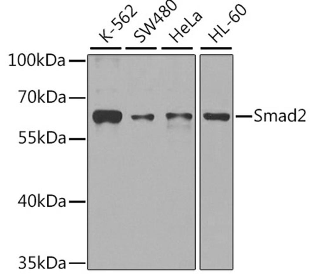 Western blot - Smad2 antibody (A7699)