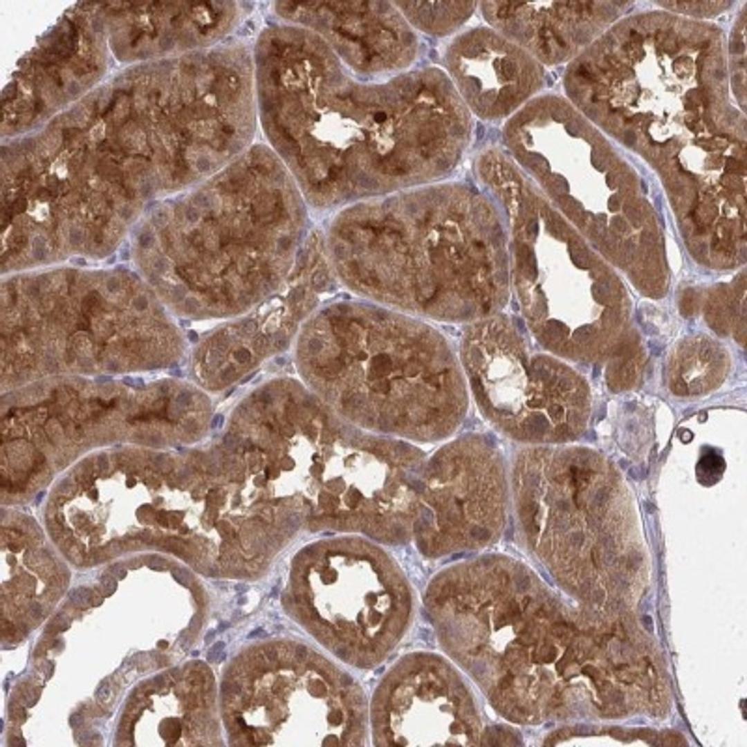 Immunohistochemistry: HDHD2 Antibody [NBP2-31799] - Staining of human kidney shows strong cytoplasmic and membranous positivity in cells in tubules.