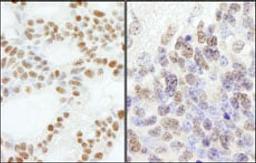 Detection of human and mouse PolE3/p17 by immunohistochemistry.