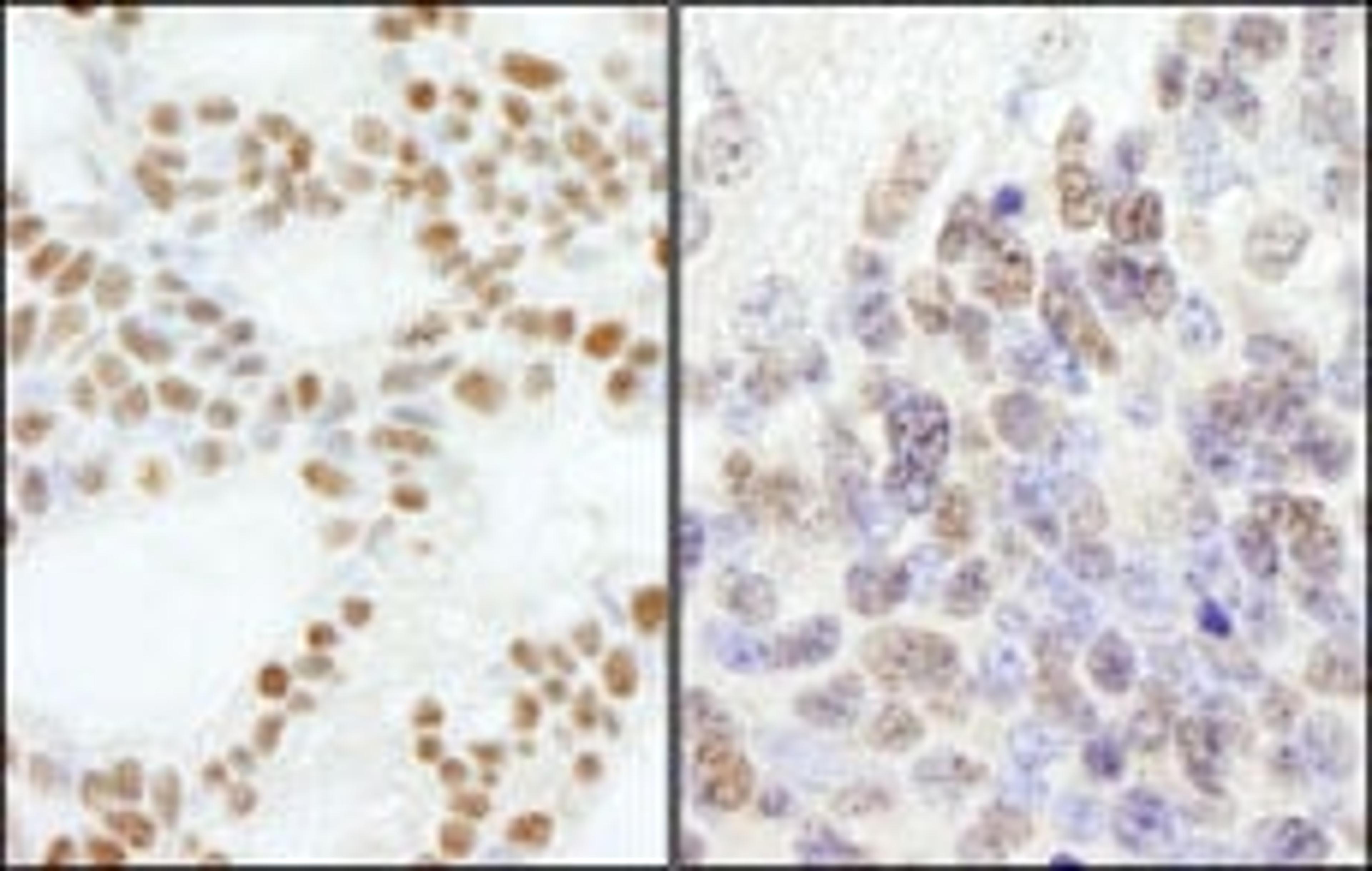 Detection of human and mouse PolE3/p17 by immunohistochemistry.