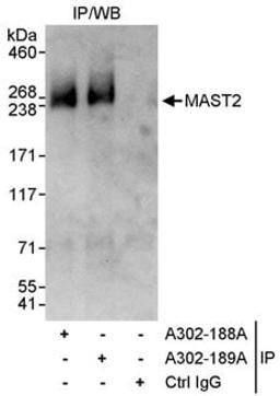 Detection of human MAST2 by western blot of immunoprecipitates.