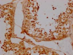 Immunohistochemistry of paraffin-embedded human testicle tissue using CSB-PA891578LA01HU at dilution of 1:300