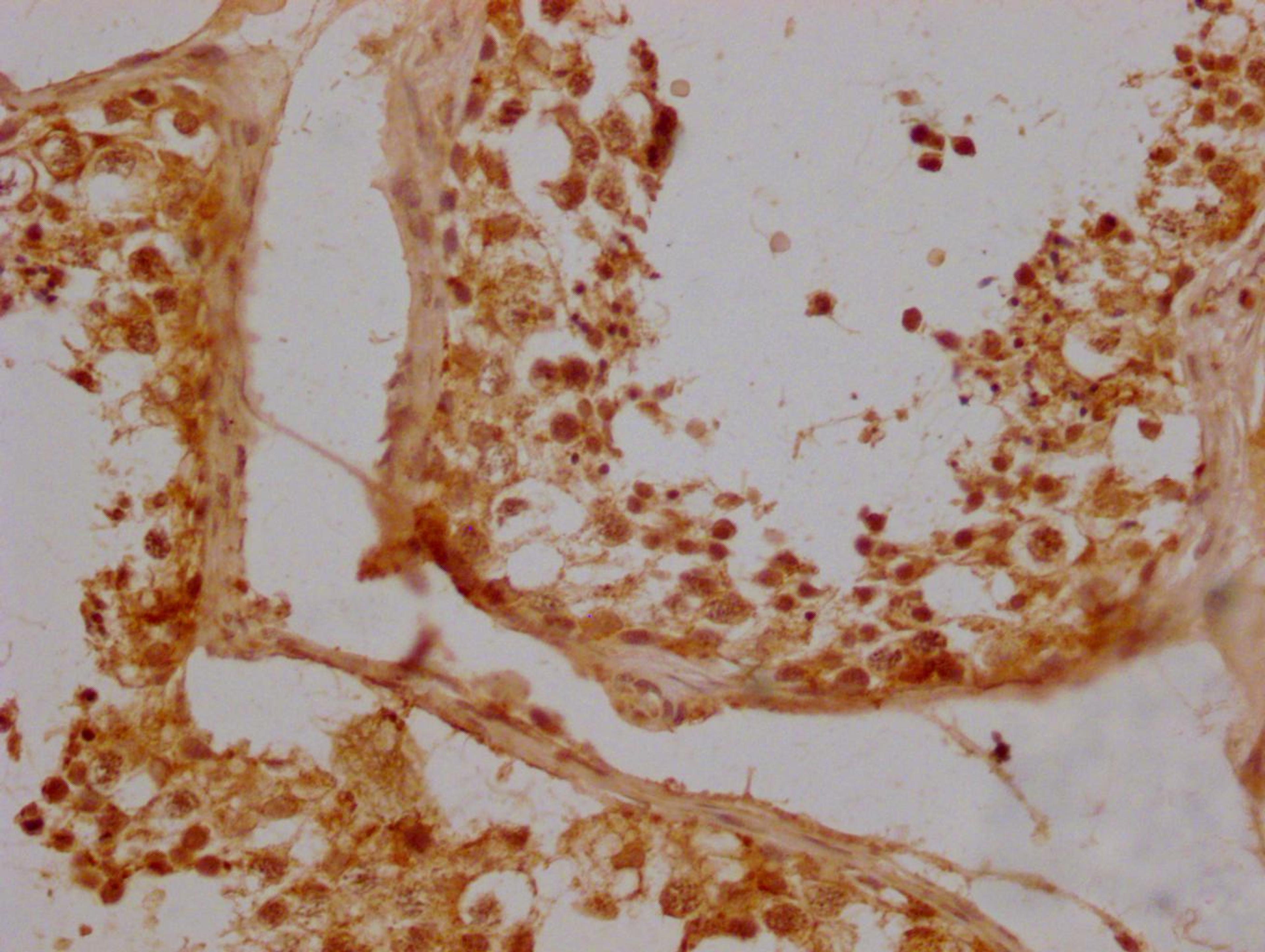 Immunohistochemistry of paraffin-embedded human testicle tissue using CSB-PA891578LA01HU at dilution of 1:300