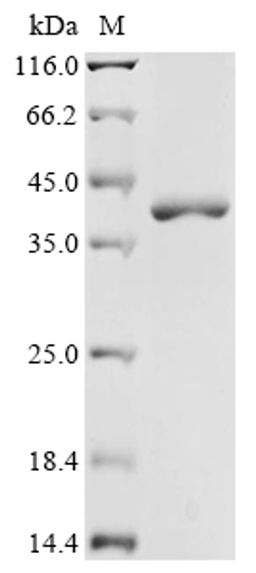(Tris-Glycine gel) Discontinuous SDS-PAGE (reduced) with 5% enrichment gel and 15% separation gel.
