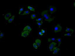 Immunofluorescence staining of Hela cell with CSB-RA004888MA2HU at 1:25, counter-stained with DAPI. The cells were fixed in 4% formaldehyde and blocked in 10% normal Goat Serum. The cells were then incubated with the antibody overnight at 4C. The secondary antibody was FITC-conjugated AffiniPure Goat Anti-Human IgG(H+L).