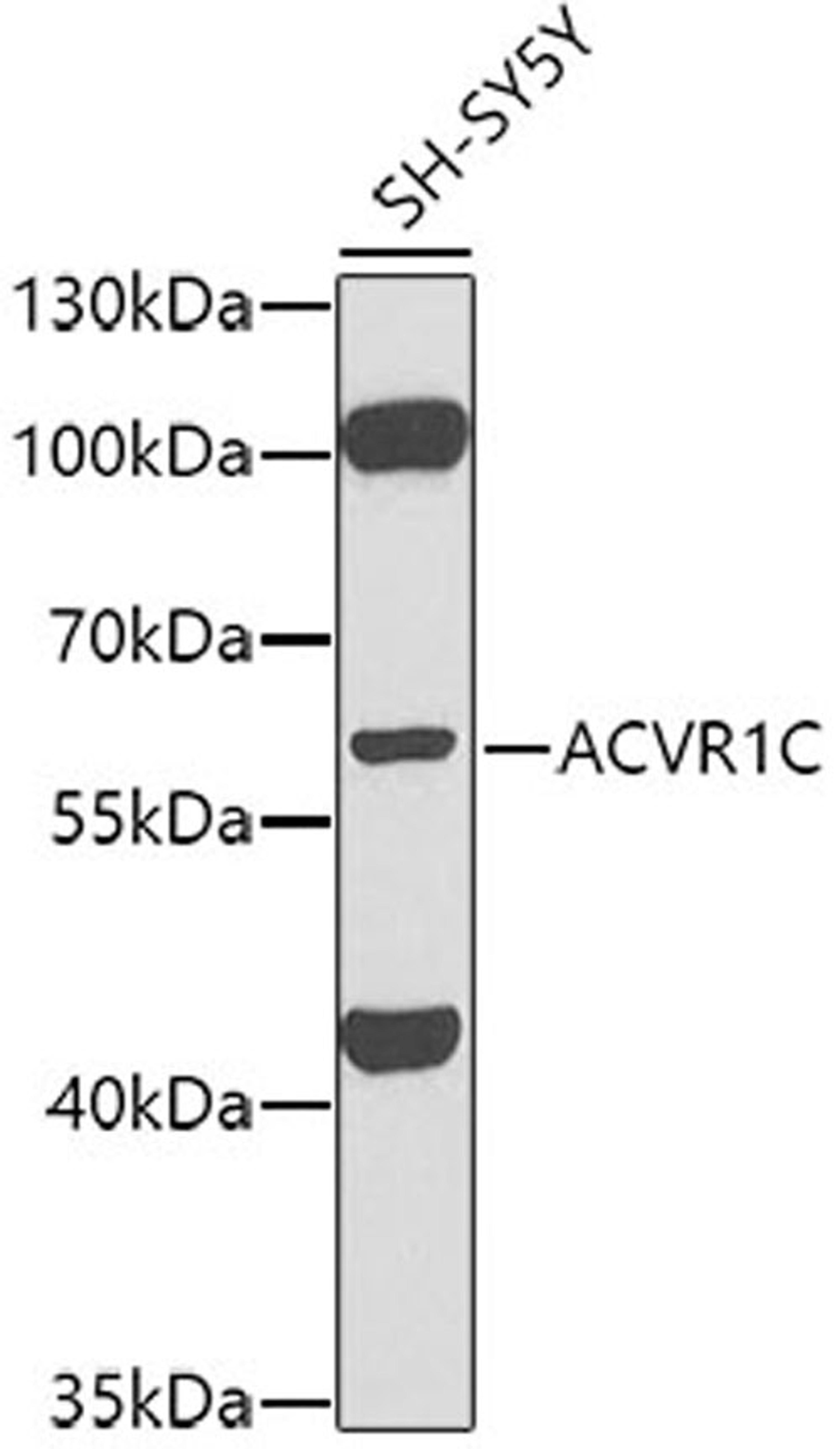 Western blot - ACVR1C antibody (A0678)