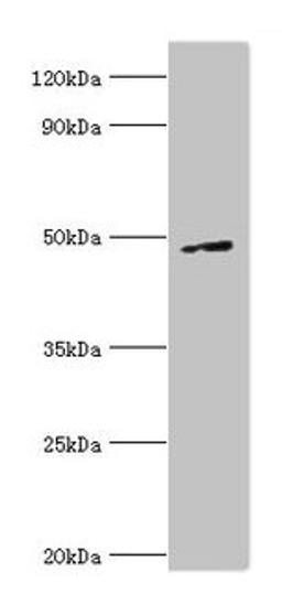 Western blot. All lanes: CTBP1 antibody at 6µg/ml + A549 whole cell lysate. Secondary. Goat polyclonal to rabbit IgG at 1/10000 dilution. Predicted band size: 48, 47 kDa. Observed band size: 48 kDa