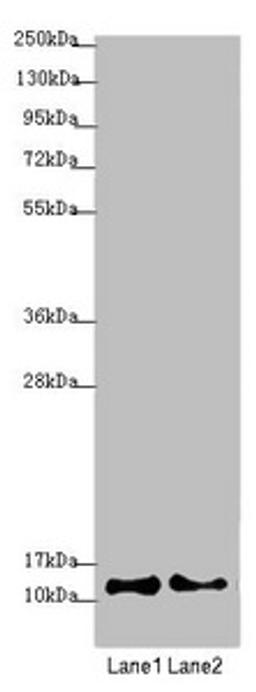 Western blot. All lanes: COX7A2L antibody at 2.08µg/ml. Lane 1: A549 whole cell lysate. Lane 2: HepG2 whole cell lysate. Secondary. Goat polyclonal to rabbit IgG at 1/10000 dilution. Predicted band size: 13 kDa. Observed band size: 13 kDa