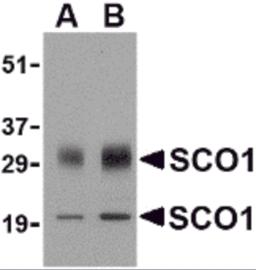 Western blot analysis of SCO1 in human brain tissue lysate with SCO1 antibody at (A) 0.5 and (B) 1 &#956;g/mL.