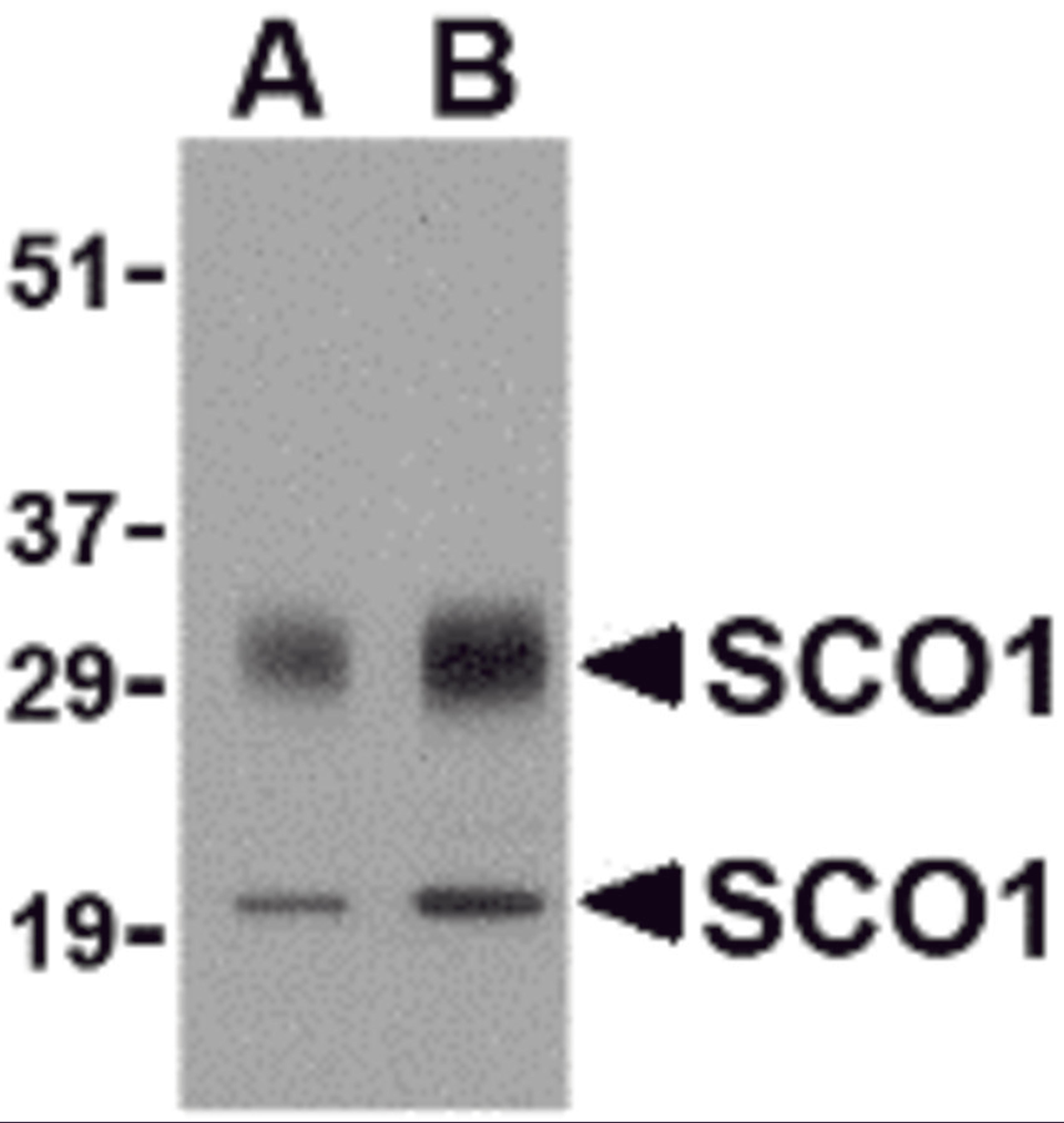 Western blot analysis of SCO1 in human brain tissue lysate with SCO1 antibody at (A) 0.5 and (B) 1 &#956;g/mL.