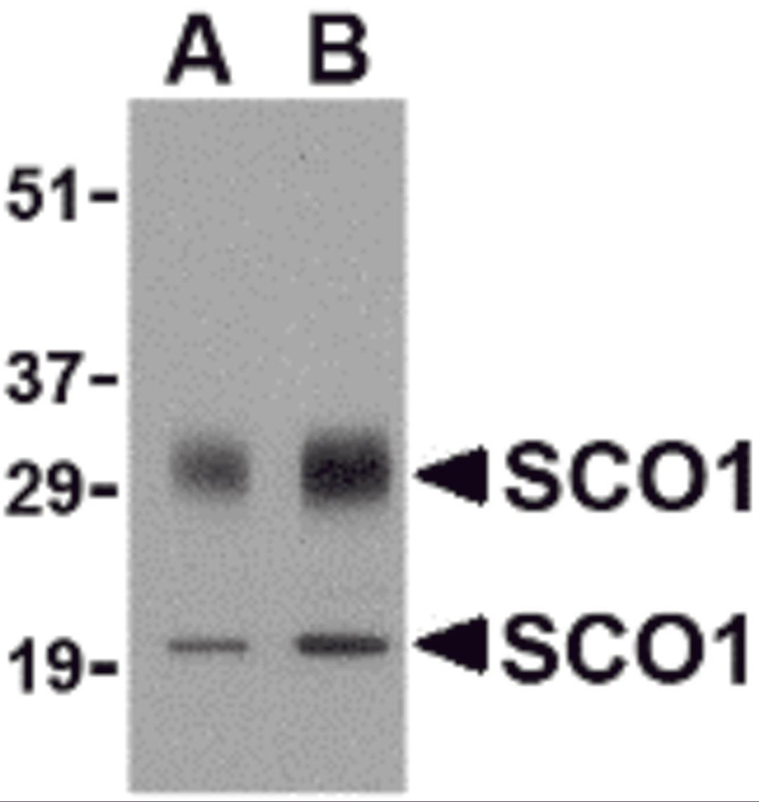 Western blot analysis of SCO1 in human brain tissue lysate with SCO1 antibody at (A) 0.5 and (B) 1 μg/mL.