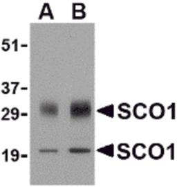 Western blot analysis of SCO1 in human brain tissue lysate with SCO1 antibody at (A) 0.5 and (B) 1 μg/mL.